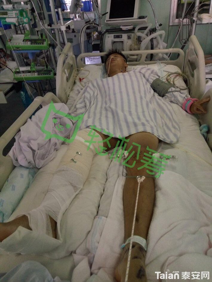 ICU ����