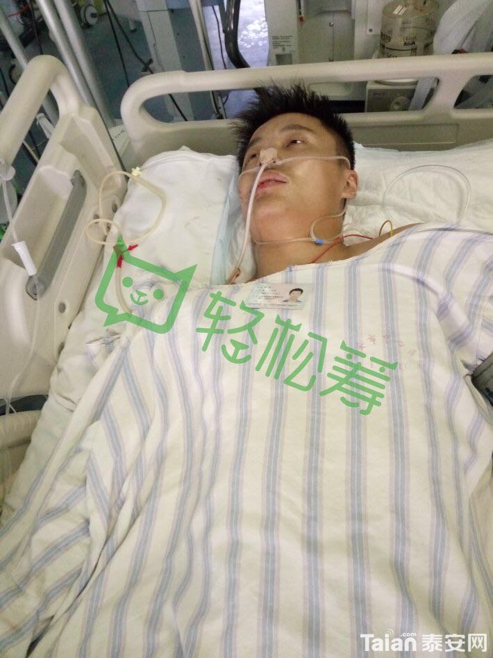 ICU����